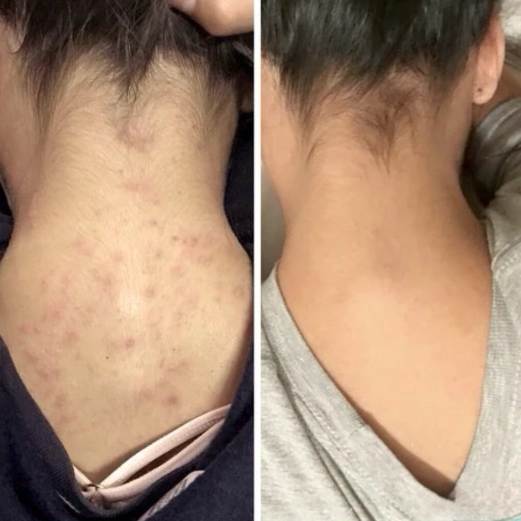 Medicube Body Brightening & Tone-Correcting Bundle (5 pcs)™