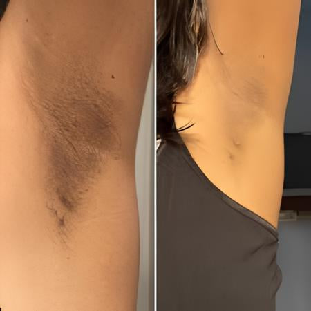 Medicube Body Brightening & Tone-Correcting Bundle (5 pcs)™